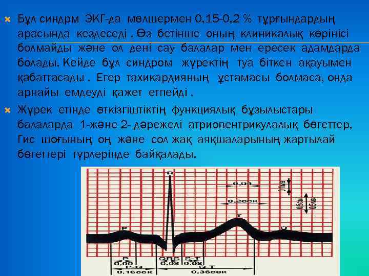  Бұл синдрм ЭКГ-да мөлшермен 0, 15 -0, 2 % тұрғындардың арасында кездеседі. Өз