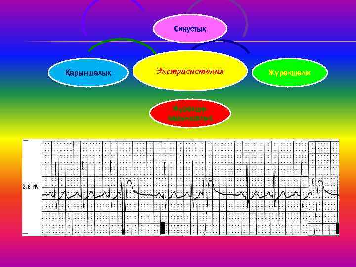 Синустық Қарыншалық Экстрасистолия Жүрекшеқарыншалық Жүрекшелік 
