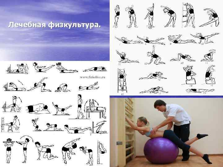 Лечебная физкультура. 
