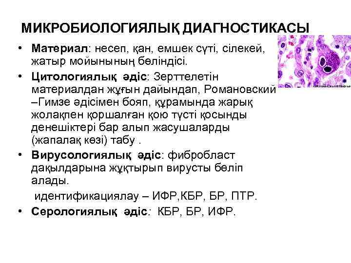 МИКРОБИОЛОГИЯЛЫҚ ДИАГНОСТИКАСЫ • Материал: несеп, қан, емшек сүті, сілекей, жатыр мойынының бөліндісі. • Цитологиялық