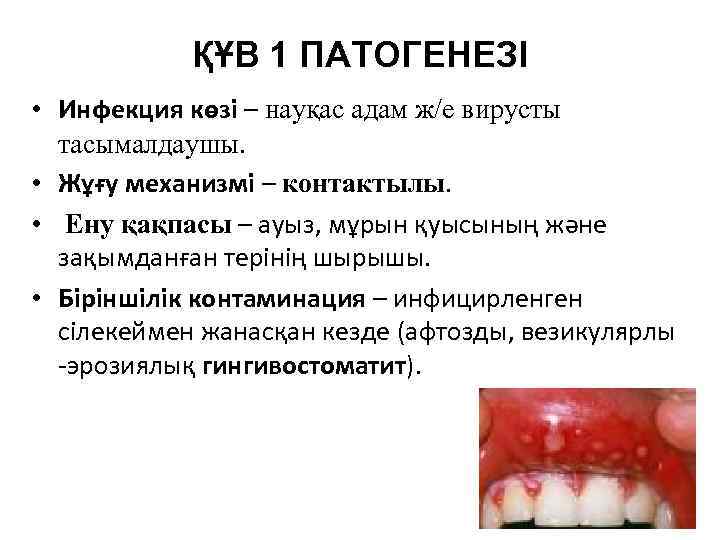 ҚҰВ 1 ПАТОГЕНЕЗІ • Инфекция көзі – науқас адам ж/е вирусты тасымалдаушы. • Жұғу