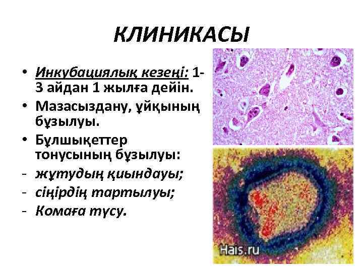 КЛИНИКАСЫ • Инкубациялық кезеңі: 13 айдан 1 жылға дейін. • Мазасыздану, ұйқының бұзылуы. •