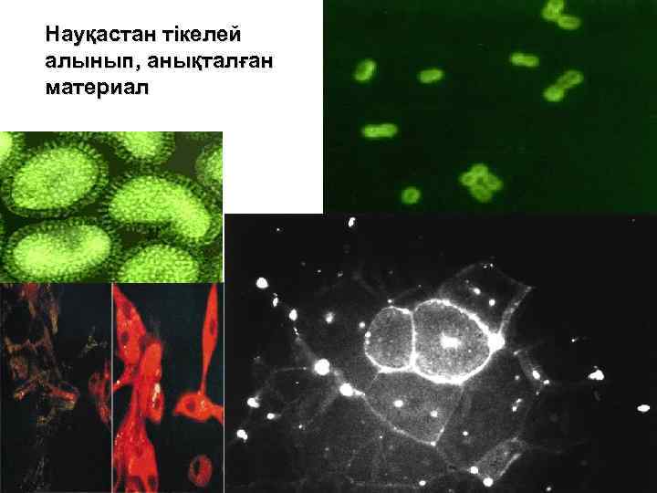 Науқастан тікелей алынып, анықталған материал 