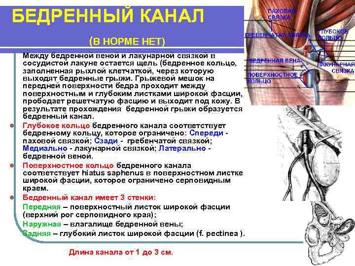БЕДРЕННЫЙ КАНАЛ (В НОРМЕ НЕТ) l l l Между бедренной веной и лакунарной связкой