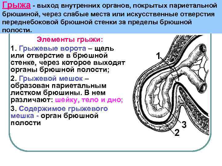 Искусственные органы фото