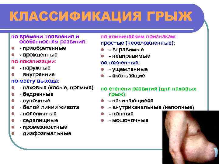 КЛАССИФИКАЦИЯ ГРЫЖ по времени появления и особенностям развития: l - приобретенные l - врожденные