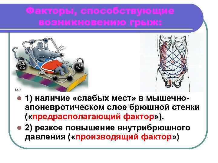 Факторы, способствующие возникновению грыж: 1) наличие «слабых мест» в мышечноапоневротическом слое брюшной стенки (