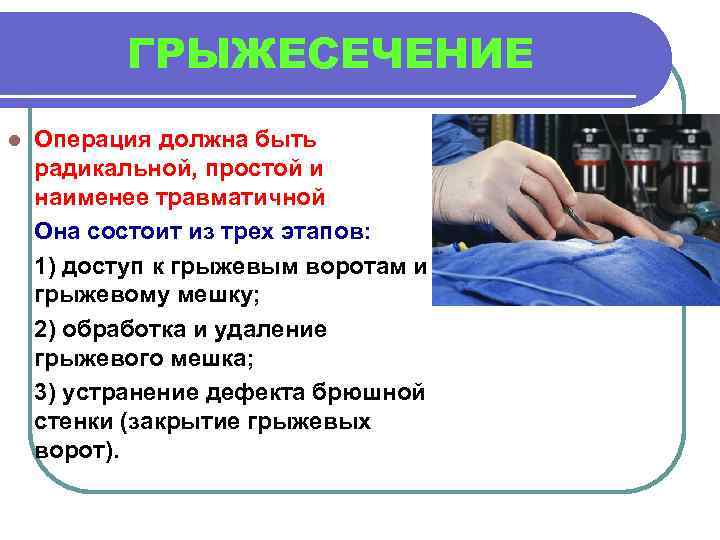 ГРЫЖЕСЕЧЕНИЕ l Операция должна быть радикальной, простой и наименее травматичной Она состоит из трех
