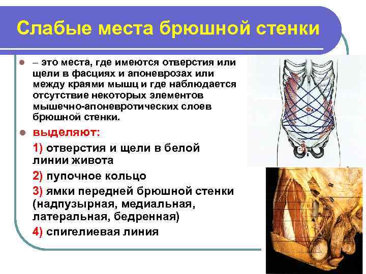Слабые места брюшной стенки l – это места, где имеются отверстия или щели в