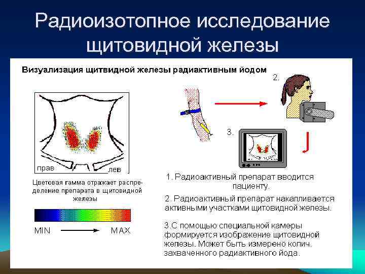 Радиоизотопное исследование щитовидной железы 