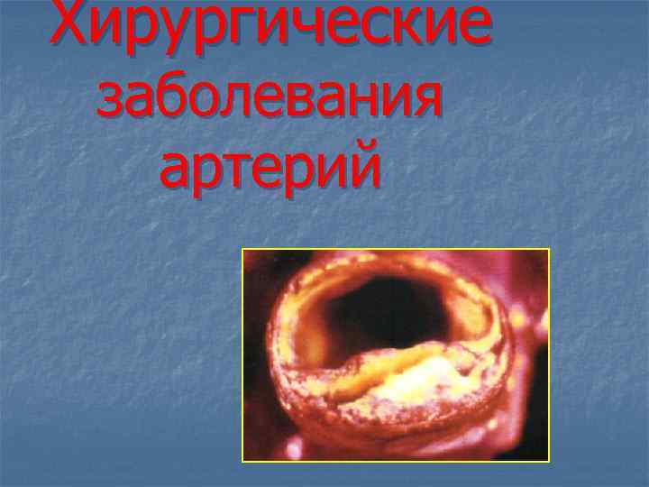 Хирургические заболевания артерий 