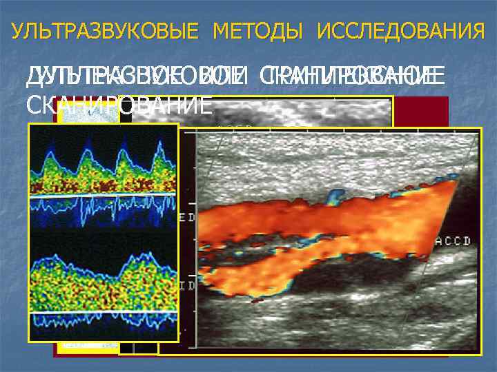 УЛЬТРАЗВУКОВЫЕ МЕТОДЫ ИССЛЕДОВАНИЯ ДУПЛЕКСНОЕ ИЛИ СКАНИРОВАНИЕ УЛЬТРАЗВУКОВОЕ ТРИПЛЕКСНОЕ СКАНИРОВАНИЕ 