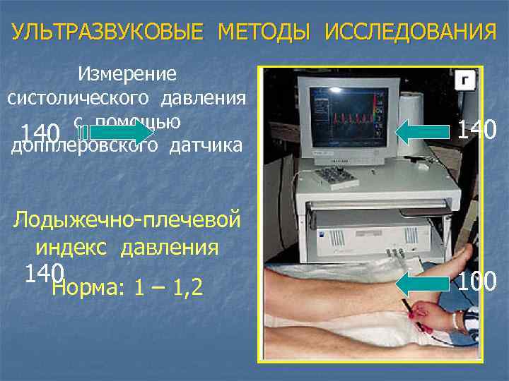 УЛЬТРАЗВУКОВЫЕ МЕТОДЫ ИССЛЕДОВАНИЯ Измерение систолического давления с помощью 140 допплеровского датчика 140 Лодыжечно-плечевой индекс
