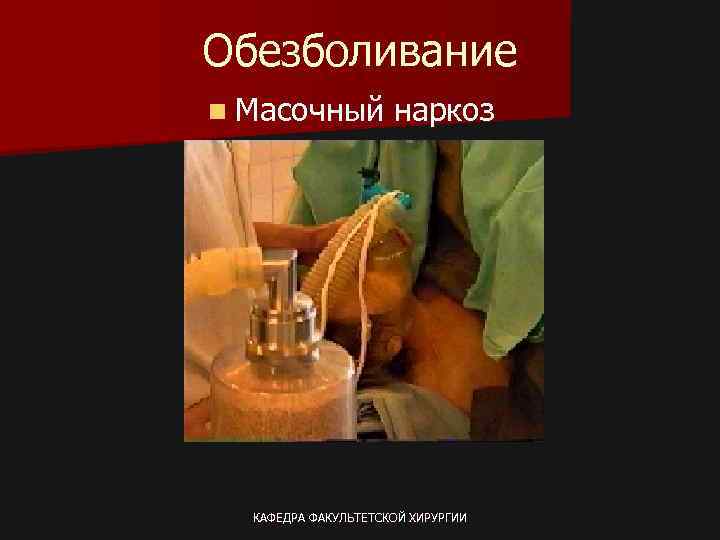 Обезболивание n Масочный наркоз КАФЕДРА ФАКУЛЬТЕТСКОЙ ХИРУРГИИ 