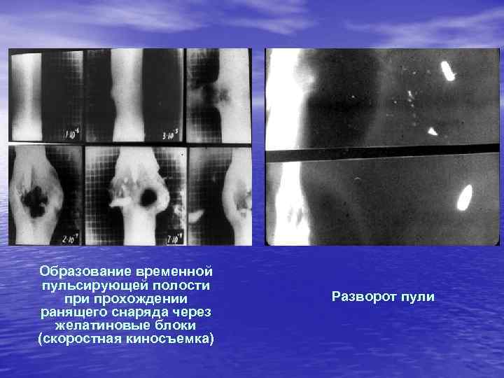 Образование временной пульсирующей полости прохождении ранящего снаряда через желатиновые блоки (скоростная киносъемка) Разворот пули