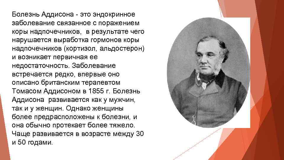 Болезнь Аддисона - это эндокринное заболевание связанное с поражением коры надпочечников, в результате чего