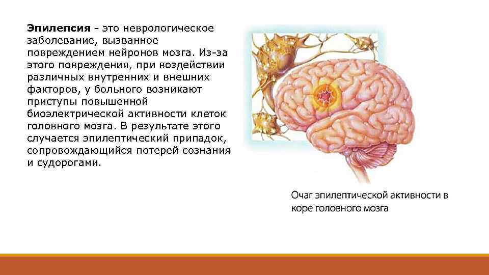 Эпилепсия - это неврологическое заболевание, вызванное повреждением нейронов мозга. Из-за этого повреждения, при воздействии