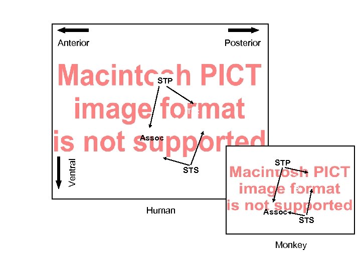 Anterior Posterior STP Tpt HG PT Ventral Assoc STS Human STP C B PB