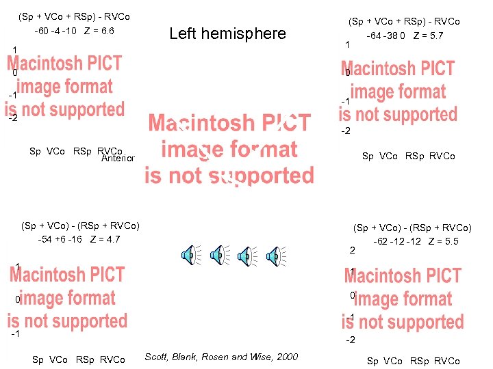 (Sp + VCo + RSp) - RVCo -60 -4 -10 Z = 6. 6