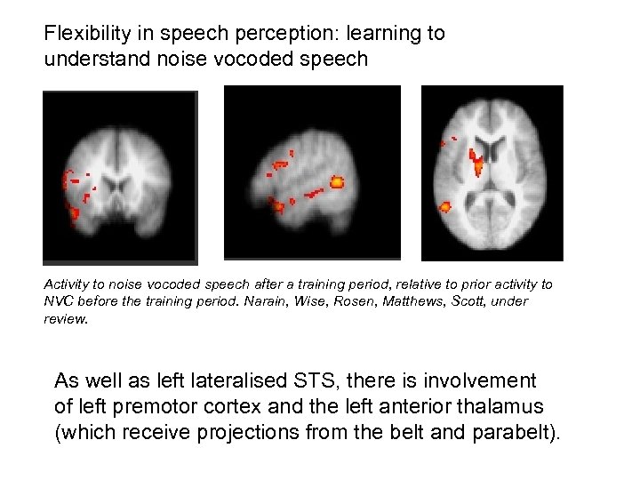 Flexibility in speech perception: learning to understand noise vocoded speech Activity to noise vocoded