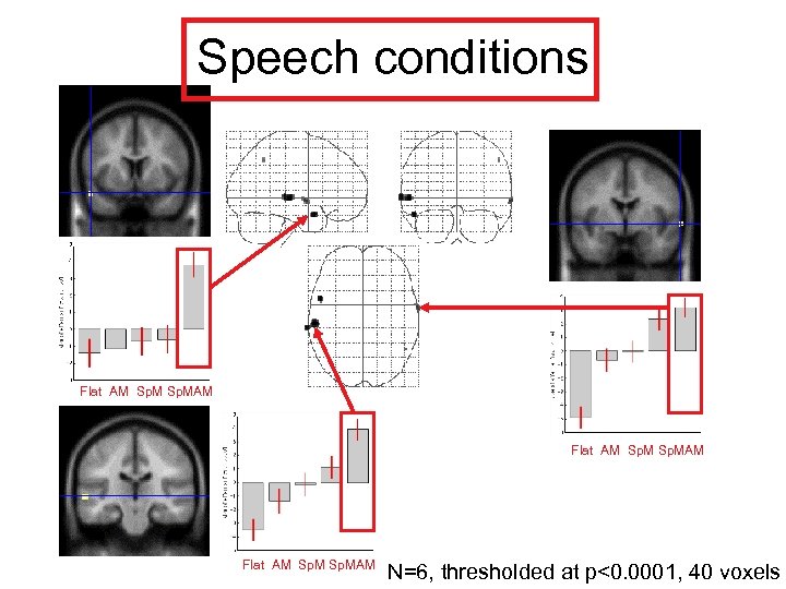 Speech conditions Flat AM Sp. MAM N=6, thresholded at p<0. 0001, 40 voxels 