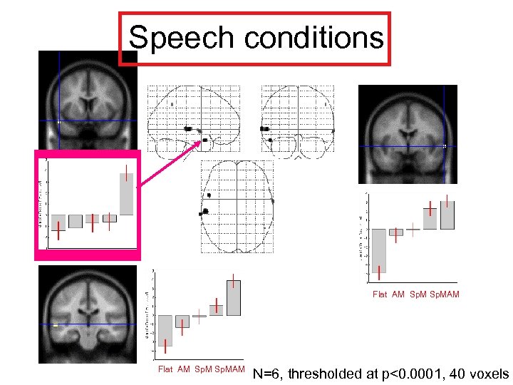 Speech conditions Flat AM Sp. MAM N=6, thresholded at p<0. 0001, 40 voxels 
