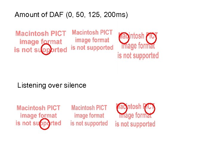 Amount of DAF (0, 50, 125, 200 ms) Listening over silence 