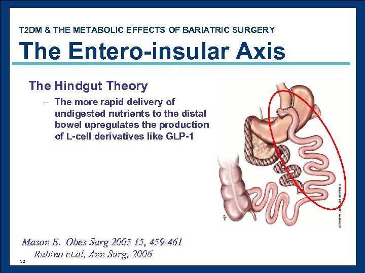 T 2 DM & THE METABOLIC EFFECTS OF BARIATRIC SURGERY The Entero-insular Axis The