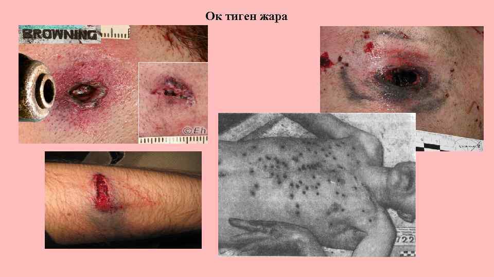 Ок тиген жара 