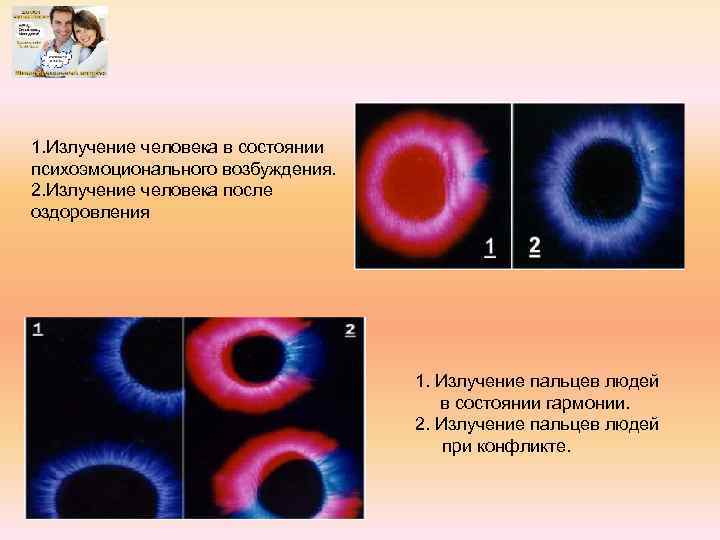 1. Излучение человека в состоянии психоэмоционального возбуждения. 2. Излучение человека после оздоровления 1. Излучение