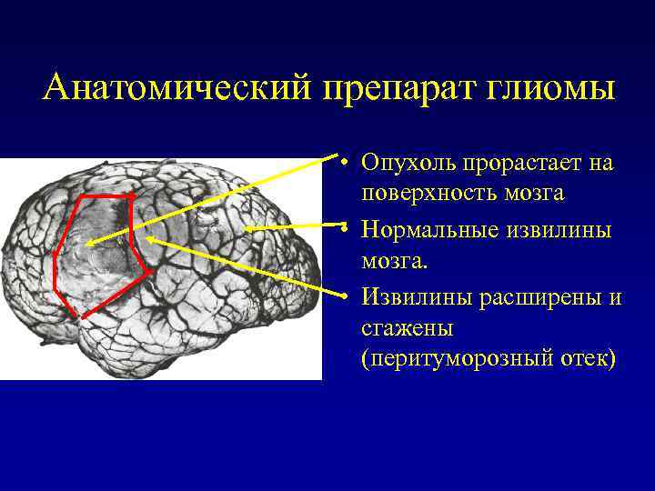 Анатомический препарат