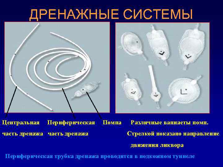 ДРЕНАЖНЫЕ СИСТЕМЫ Центральная Периферическая часть дренажа Помпа Различные вапиаеты помп. Стрелкой показано направление движения