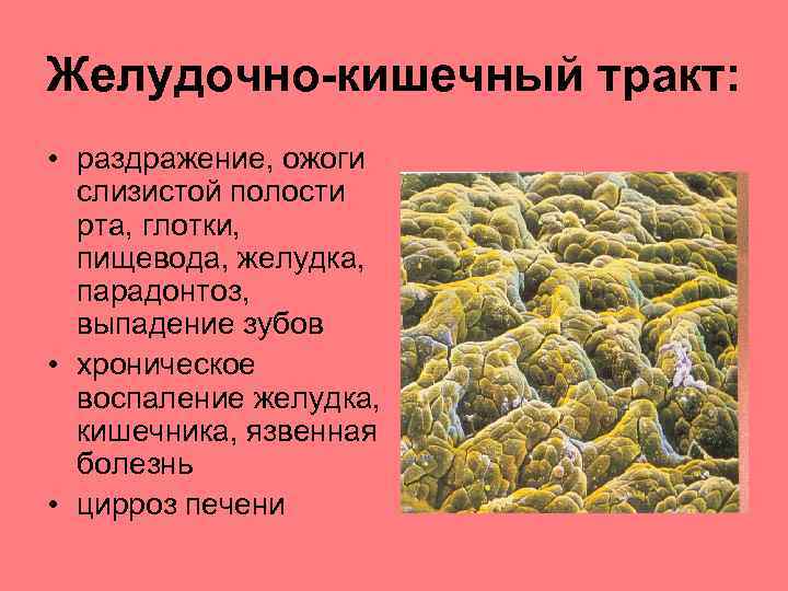 Желудочно-кишечный тракт: • раздражение, ожоги слизистой полости рта, глотки, пищевода, желудка, парадонтоз, выпадение зубов