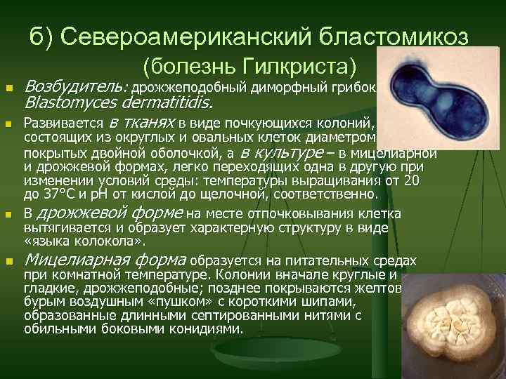 б) Североамериканский бластомикоз (болезнь Гилкриста) n n Возбудитель: дрожжеподобный диморфный грибок Blastomyces dermatitidis. Развивается