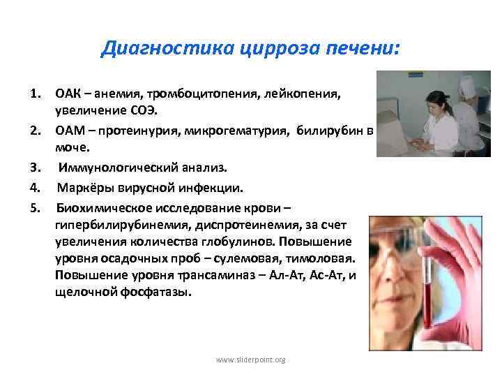 Диагностика цирроза печени: 1. ОАК – анемия, тромбоцитопения, лейкопения, увеличение СОЭ. 2. ОАМ –