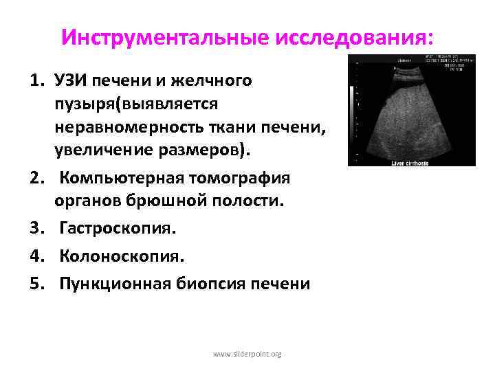 Инструментальные исследования: 1. УЗИ печени и желчного пузыря(выявляется неравномерность ткани печени, увеличение размеров). 2.