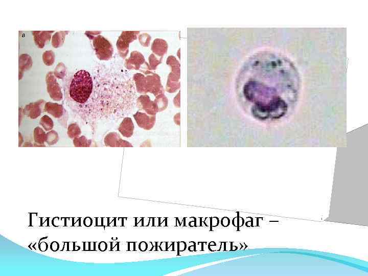 Макрофаги в тканях. Макрофаги гистиоциты. Гистиоциты в цитологии. • Гистиоциты (тканевые макрофаги). Гистиоциты гистология.