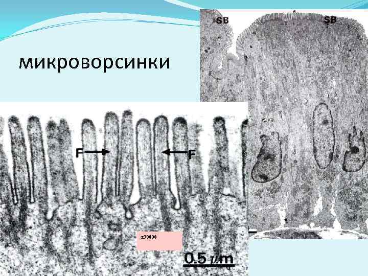 микроворсинки х30000 