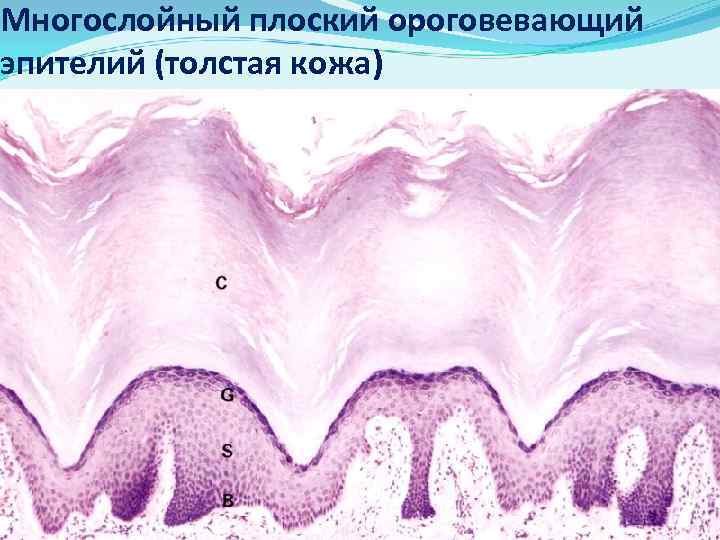 Многослойный плоский ороговевающий эпителий (толстая кожа) 