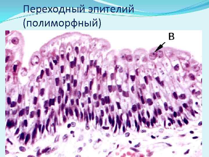 Переходный эпителий (полиморфный) 