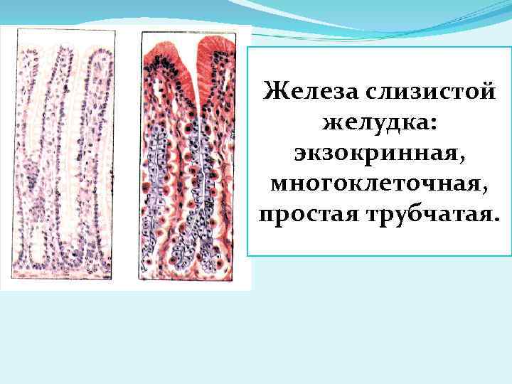 Слизистая железа. Простые трубчатые железы желудка. Простая трубчатая неразветвленная железа желудка. Многоклеточные слизистые железы у. Многоклеточные простые трубчатые железы.