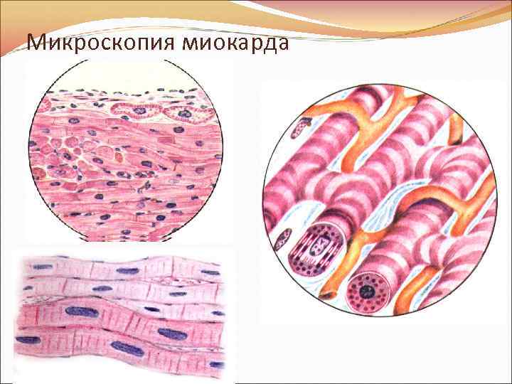 Миокард гистология рисунок