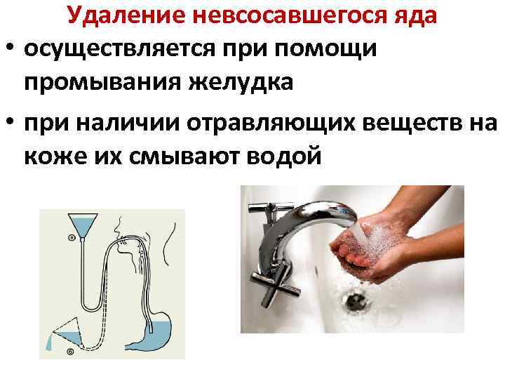 Удаление невсосавшегося яда • осуществляется при помощи промывания желудка • при наличии отравляющих веществ