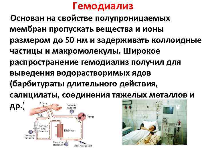 Гемодиализ Основан на свойстве полупроницаемых мембран пропускать вещества и ионы размером до 50 нм