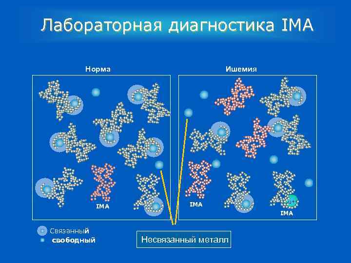 Лабораторная диагностика IMA Норма IMA Связанный свободный Ишемия IMA Cu++ IMA Несвязанный металл 