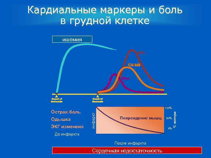 Кардиальные маркеры и боль в грудной клетке ишемия ЭКГ изменеия Повреждение мышц 50% 0%