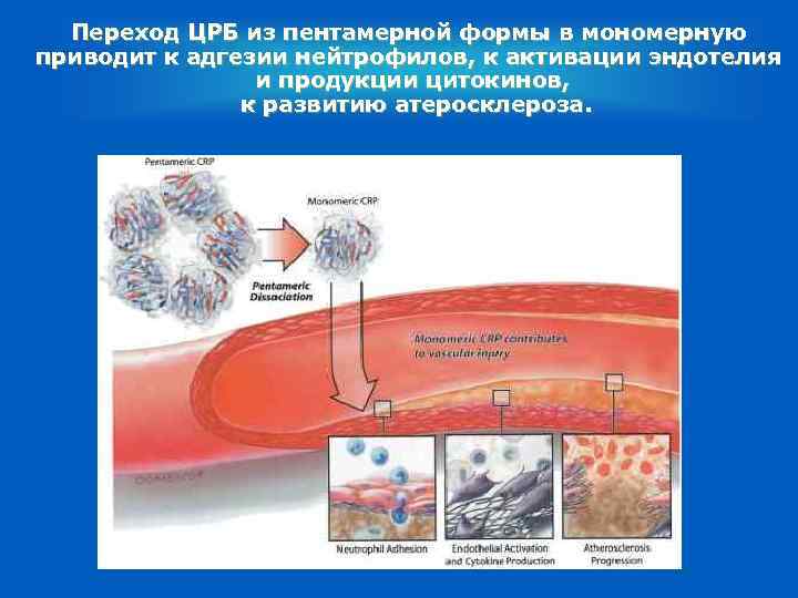 Переход ЦРБ из пентамерной формы в мономерную приводит к адгезии нейтрофилов, к активации эндотелия