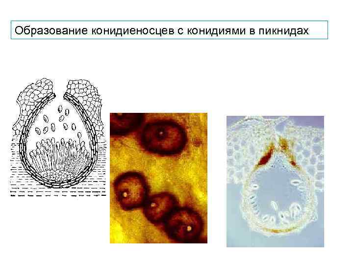 Образование конидиеносцев с конидиями в пикнидах 