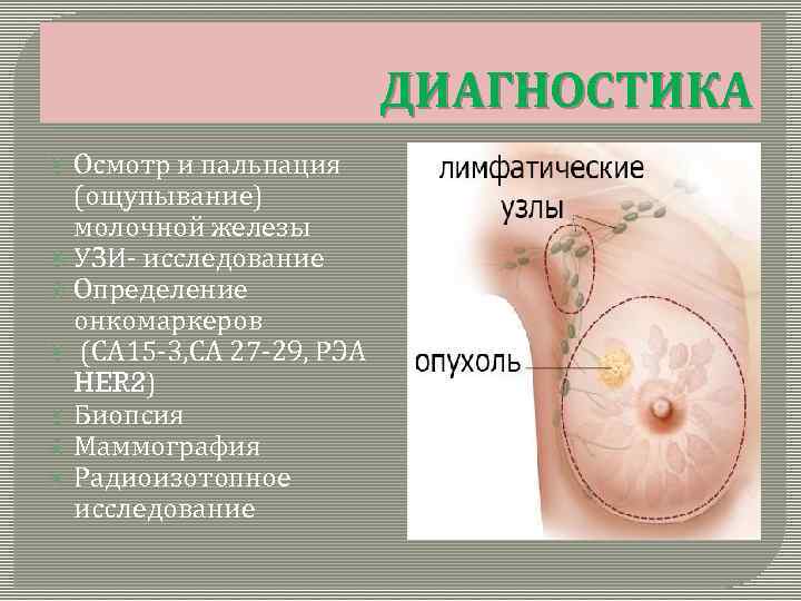 ДИАГНОСТИКА Осмотр и пальпация (ощупывание) молочной железы УЗИ- исследование Определение онкомаркеров (СА 15 -3,