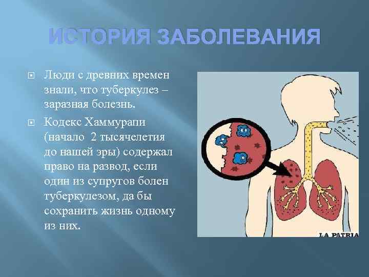 ИСТОРИЯ ЗАБОЛЕВАНИЯ Люди с древних времен знали, что туберкулез – заразная болезнь. Кодекс Хаммурапи